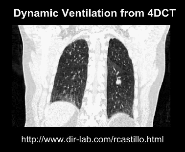 dynamicventilation