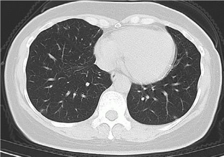 radiol.2020200432.fig3b