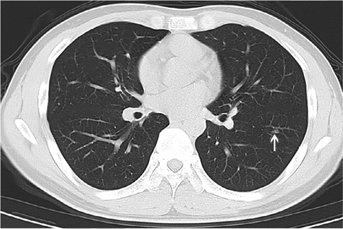 radiol.2020200432.fig3d
